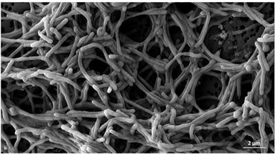 Tenacibaculosis caused by Tenacibaculum maritimum: Updated knowledge of this marine bacterial fish pathogen